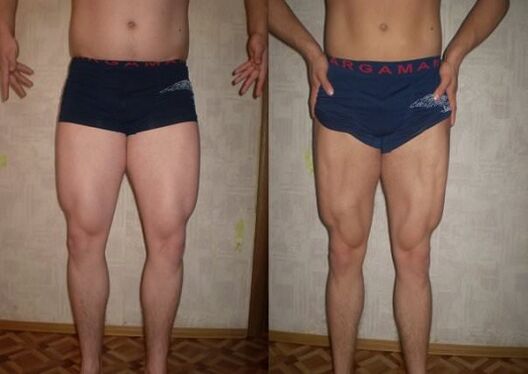 before and after following a keto diet